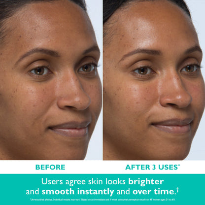 Even Smoother™ Instant Reveal Facial Peel|8 cotton swabs